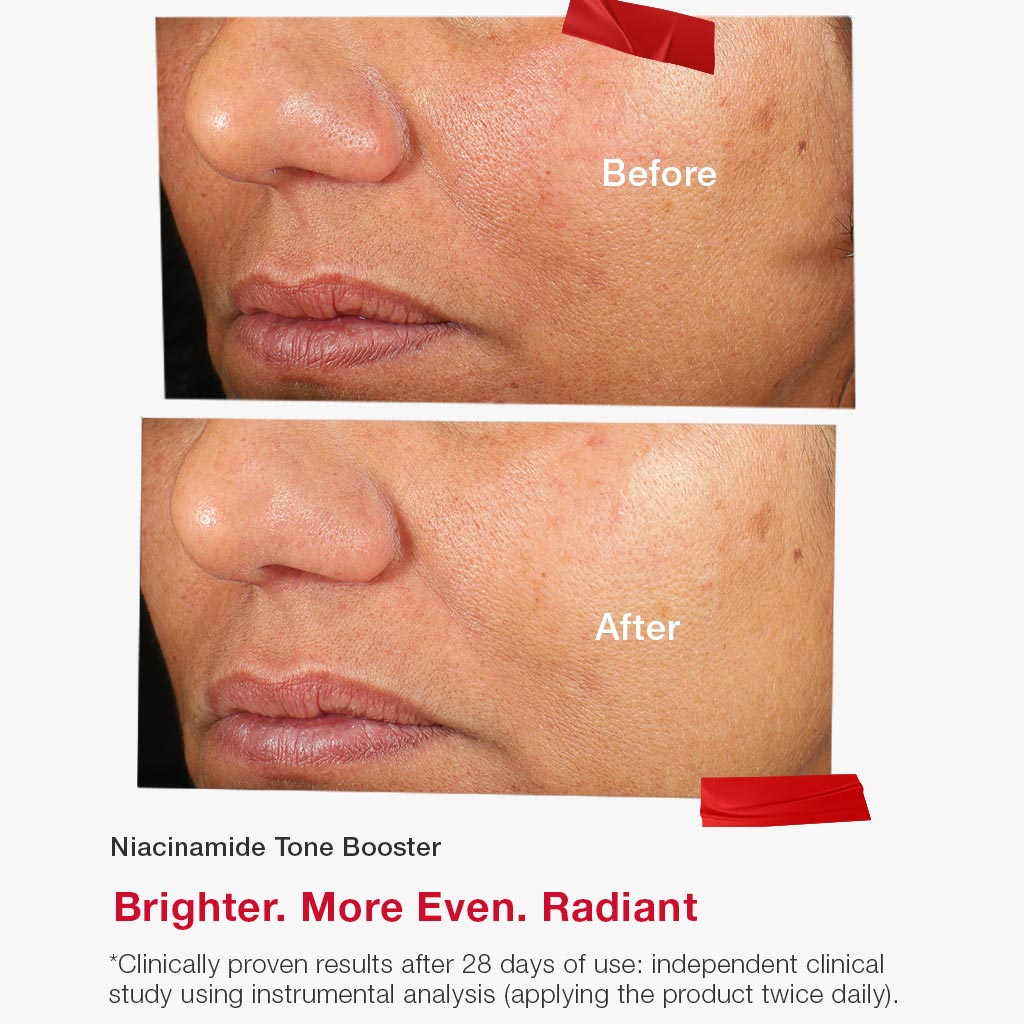 Niacinamide Tone Booster